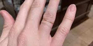 Metallic Abrasion: Why Your Jewelry Leaves Black or Green Marks on Your Skin (and How to Fix It)
